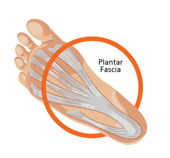 Plantar Fascia Foot Diagram