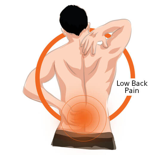 Low Back Pain Image